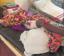 Masanga Hospital in Sierra Leone: Behandlung mit Traktion eines gebrochenen Oberschenkelknochens bei einem verunglückten Jungen. Studentengruppe der Physiotherapie-Ausbildung, mit Ausbildner Ellard von Molen (3. v. l.) und die Kinderabteilung des Hospitals. (Bilder: zVg.)